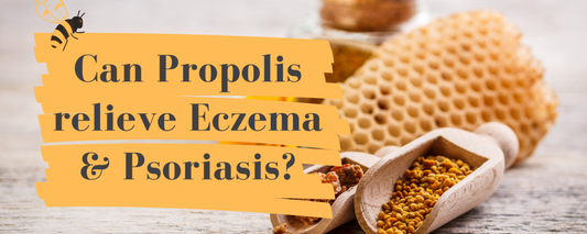 Why Propolis May Be the Answer to Relieving Your Psoriasis and Eczema