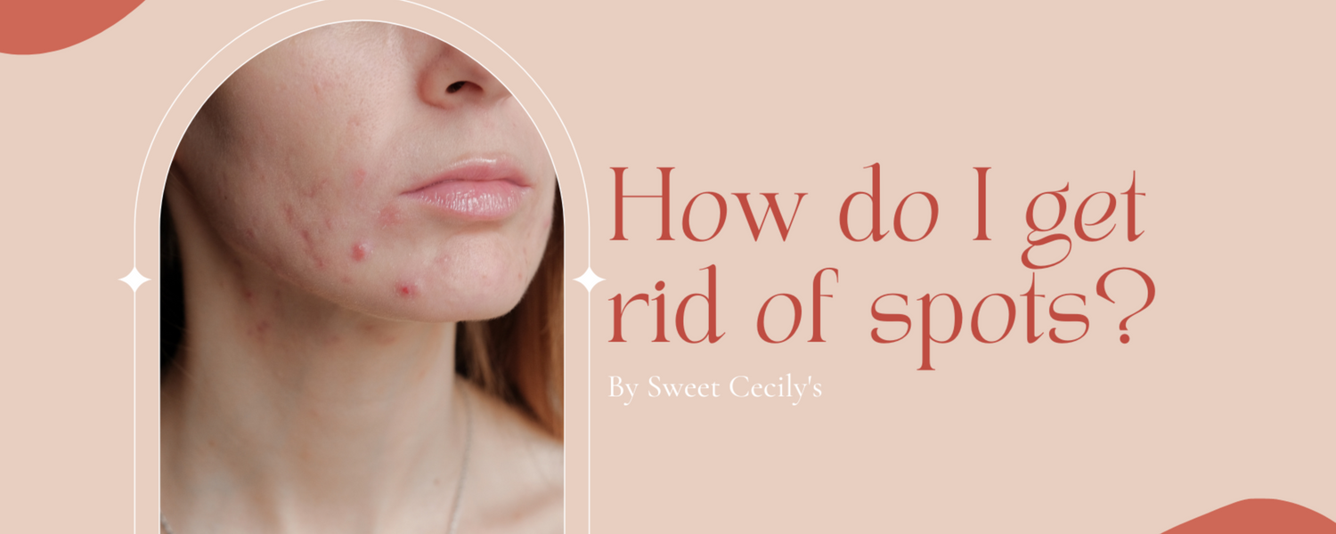 Top Tips and Healthy Habits To Help Get Rid of Spots Sweet Cecily's